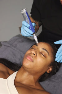 Microneedling- Package of 3 for $700.  But 2, Get 1 Free