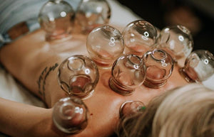 Cupping- 6 Sessions of Cupping $200